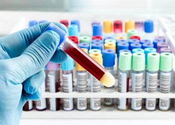 hand of a lab technician holding blood tube test and background a rack of color tubes with blood samples other patients / laboratory technician holding a blood tube test